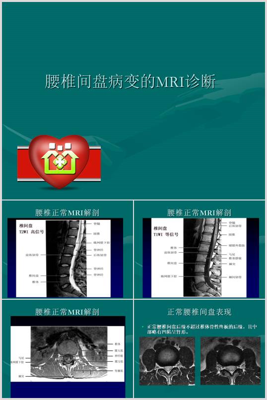 ׵gP׃MRI\Ӗn(PPT 32)