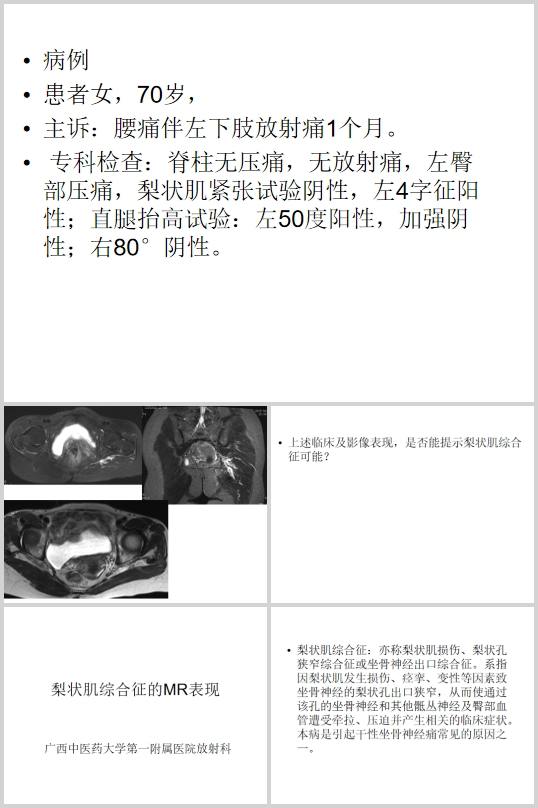 MRC\еđú(PPT 40)